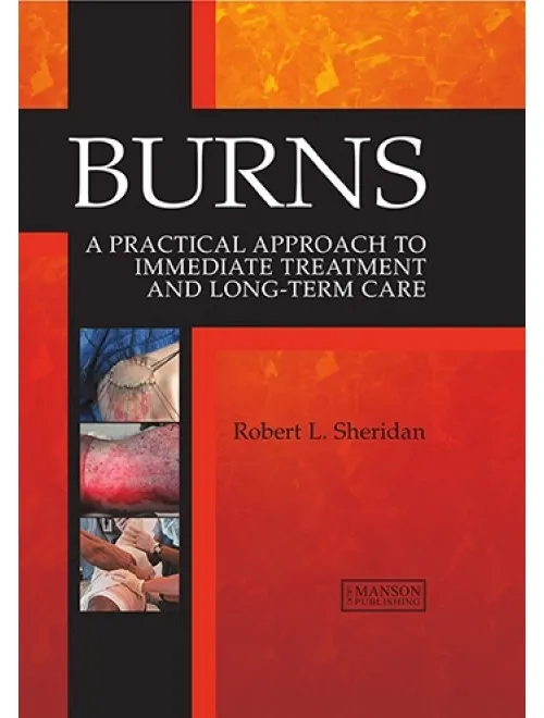 Burns - A Practical Approach - 1st Edition
