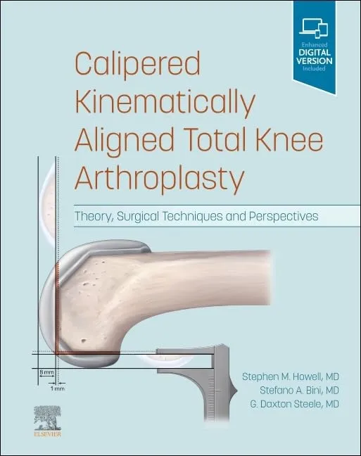 Calipered Kinematically aligned Total Knee Arthroplasty-1E