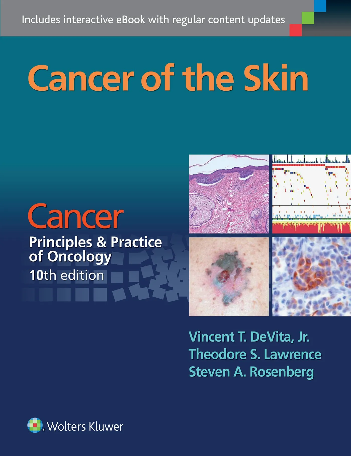 Cancer of the Skin: Cancer:  Principles and Practice of Oncology - 10th Edition