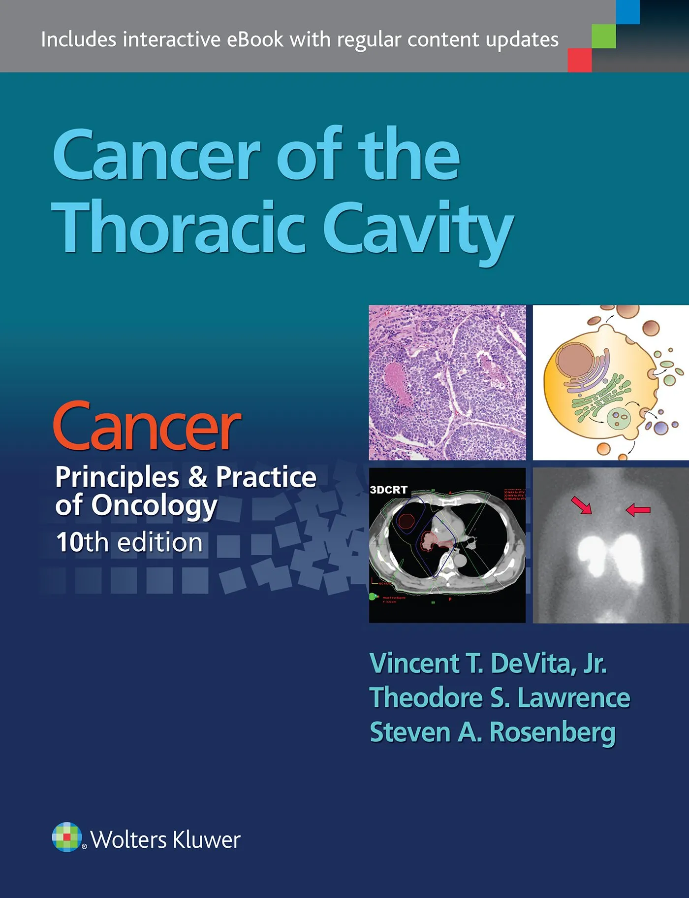 Cancer of the Thoracic Cavity: Cancer:  Principles and Practice of Oncology - 10th Edition