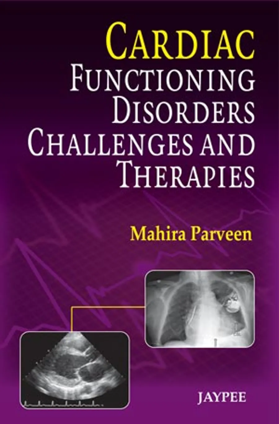 Image of Cardiac Functioning, Disorders, Challenges and Therapies