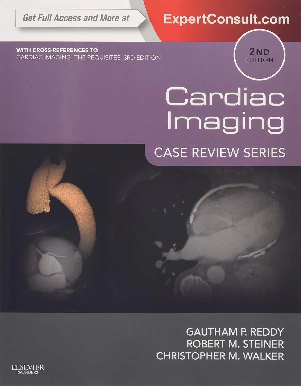 Cardiac Imaging- Case Review Series-2E
