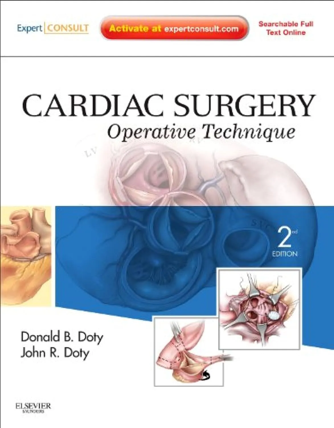 Image of Cardiac Surgery: Operative Technique - 2E