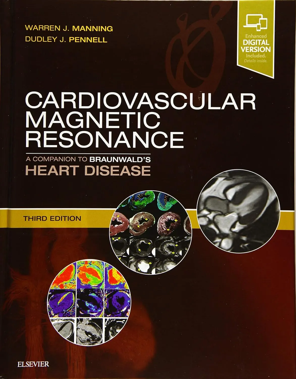 Image of Cardiovascular Magnetic Resonance -3E