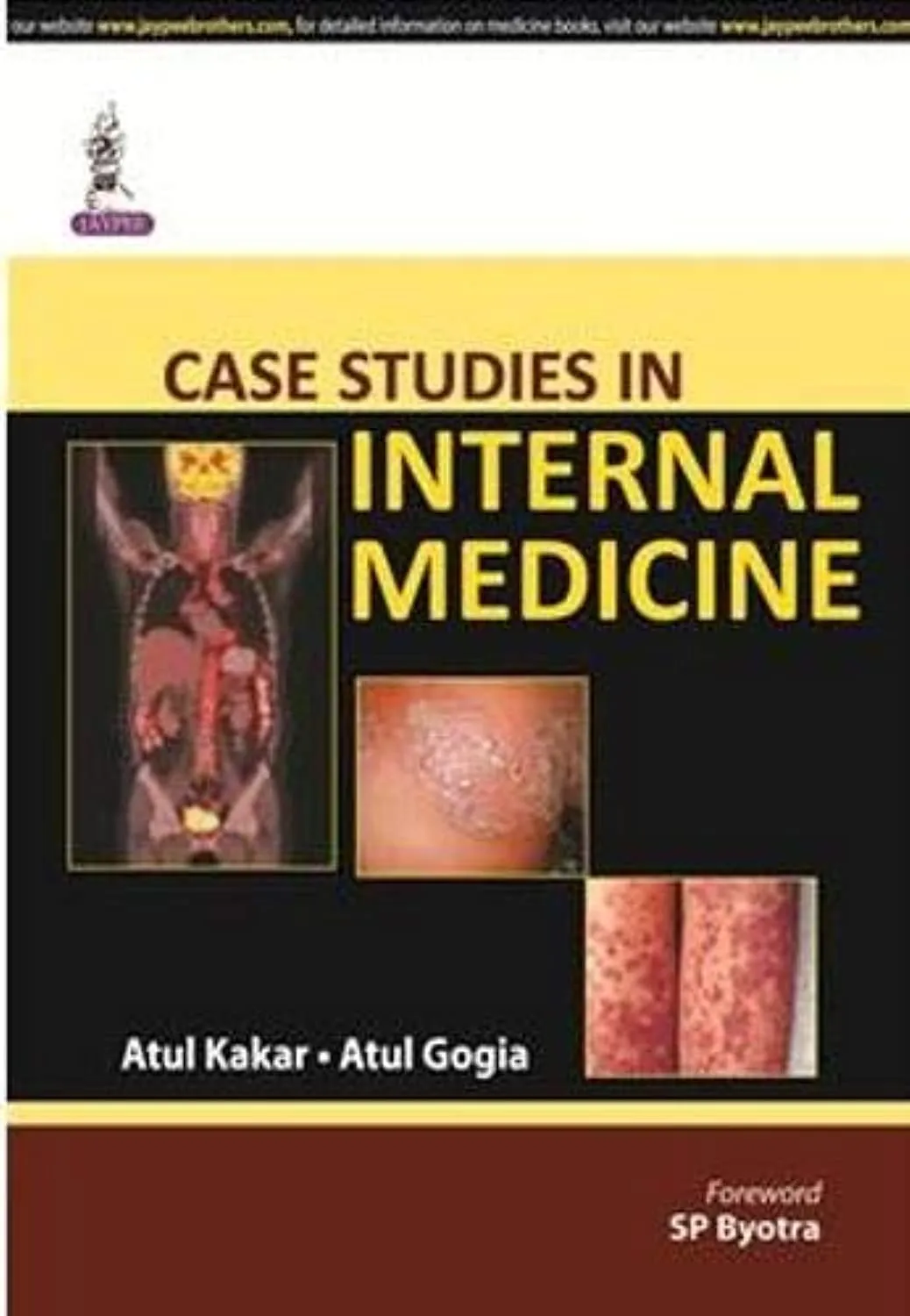 Case Studies in Internal Medicine - 1st Edition 2014