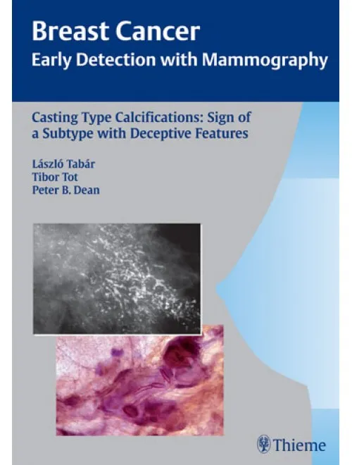Casting Type Calcifications: Sign Of A Subtype With Deceptive Features - 1st Edition