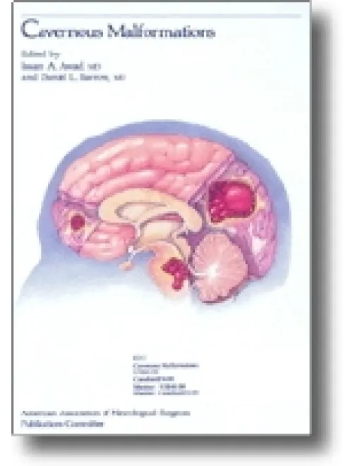 Cavernous Malformations - 1st Edition
