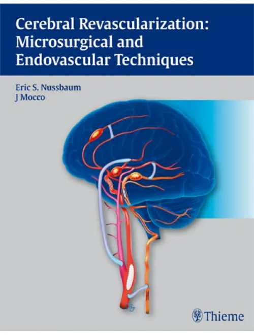 Cerebral Revascularization Microsurgical and Endov - 1st Edition