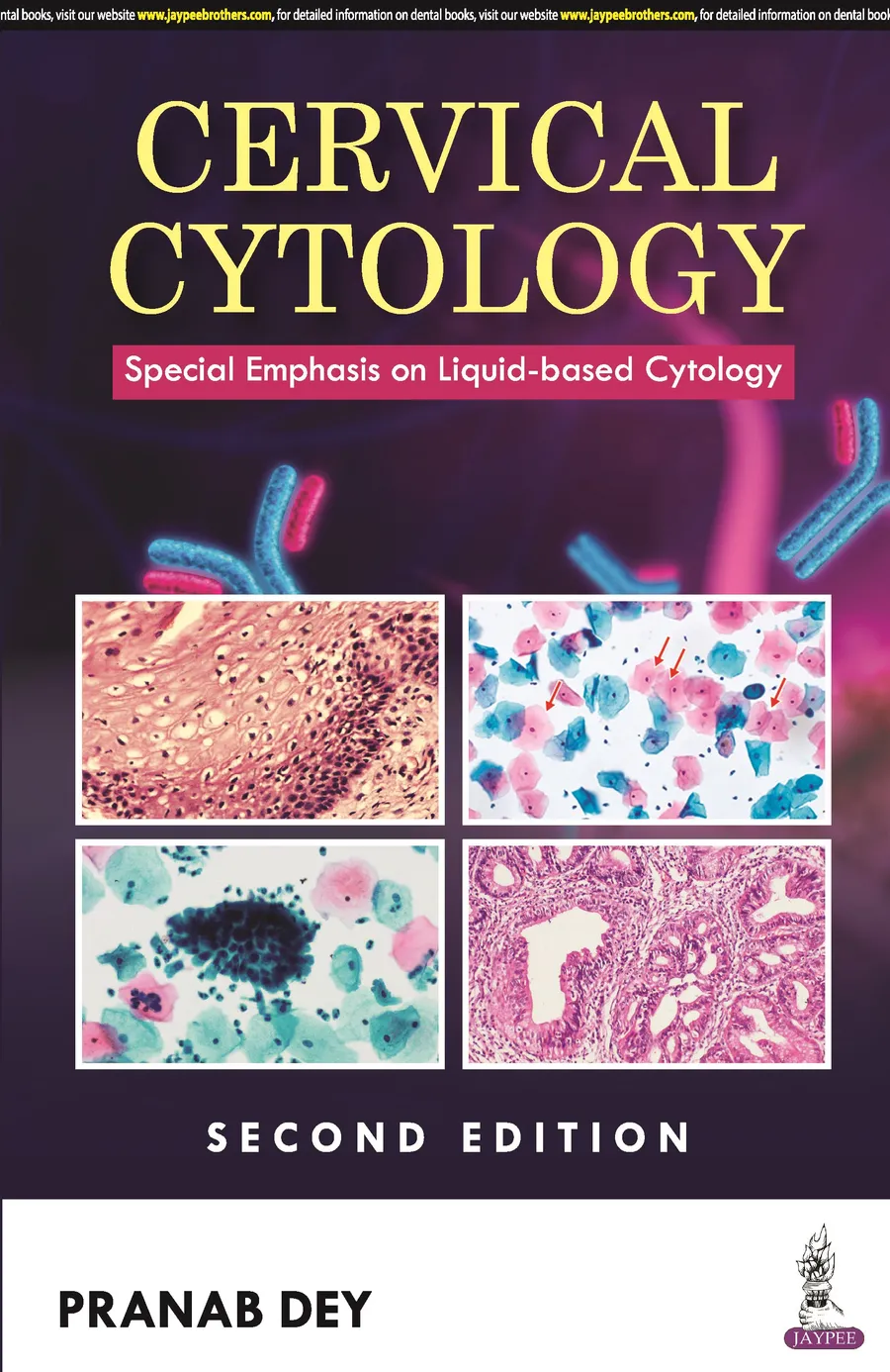 Cervical Cytology | Special Emphasis on Liquid-based Cytology