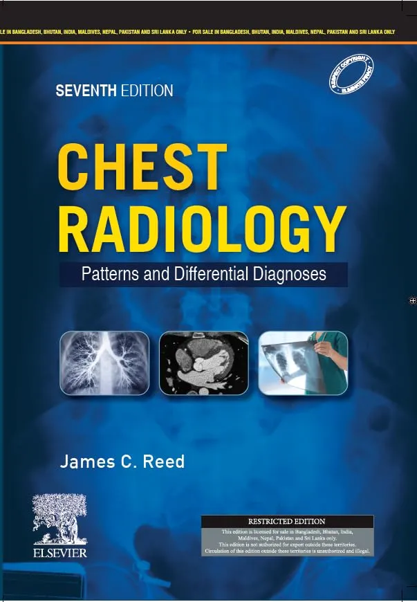Chest Radiology: Patterns and Differential Diagnoses (SAE) -7E