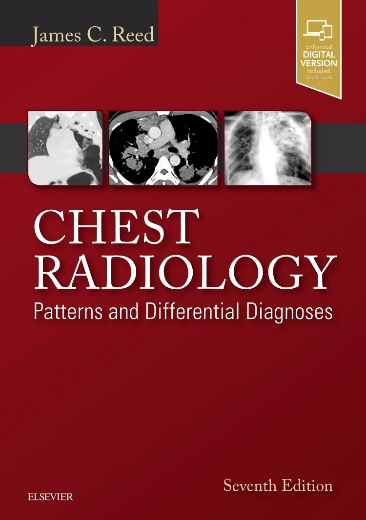 Chest Radiology: Patterns and Differential Diagnoses -7E