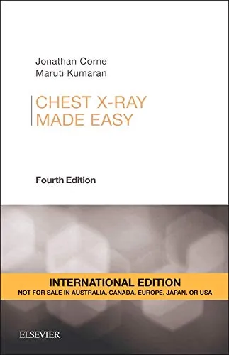 Chest  X-Ray Made Easy IE - 4E