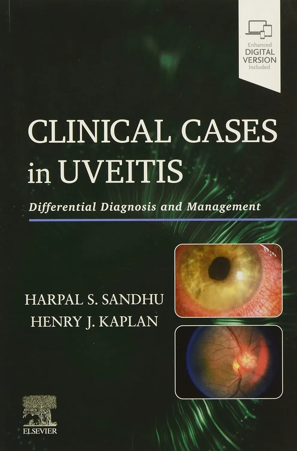 Clinical Cases in Uveitis-1E