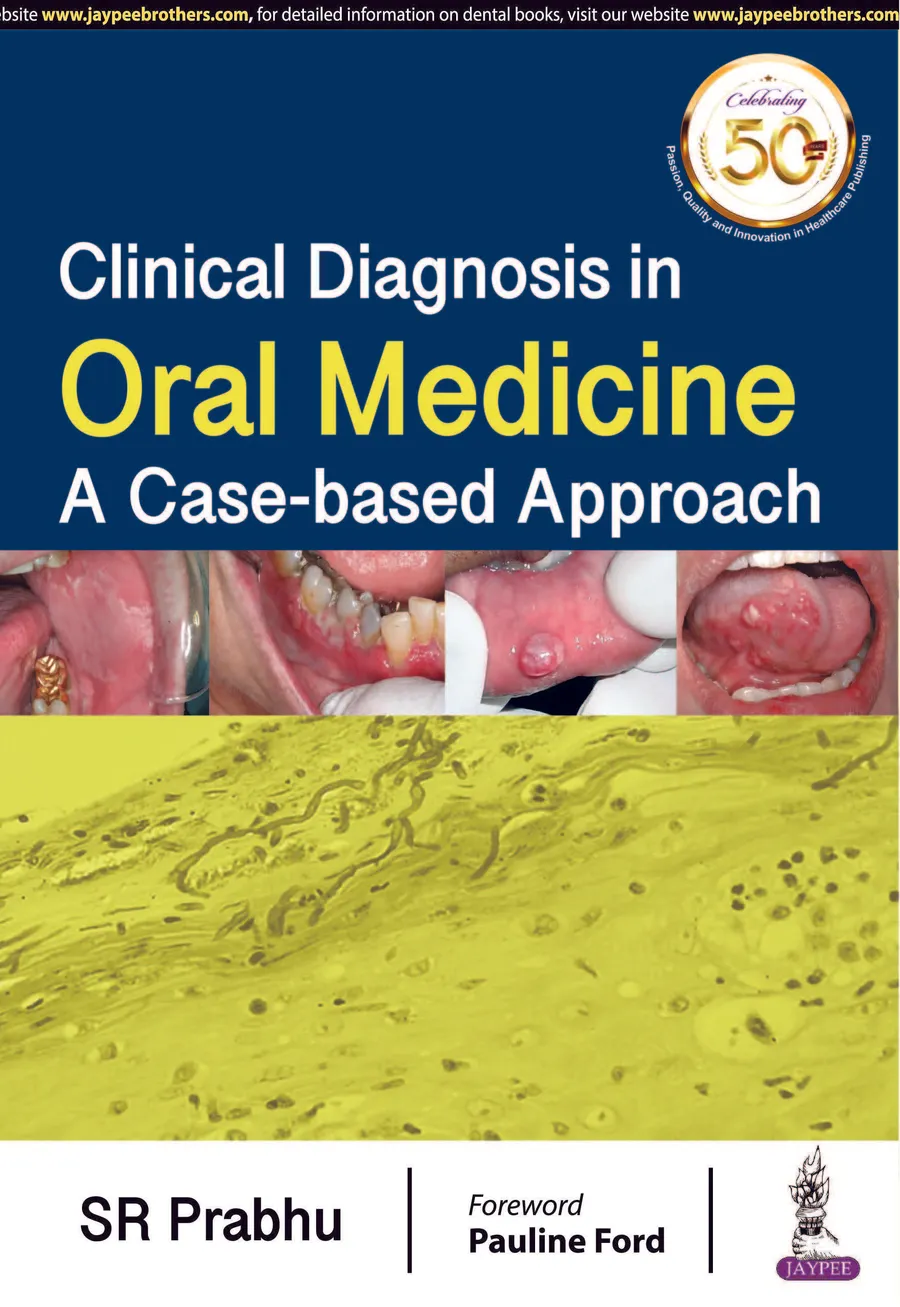 Clinical Diagnosis in Oral Medicine | A Case-based Approach