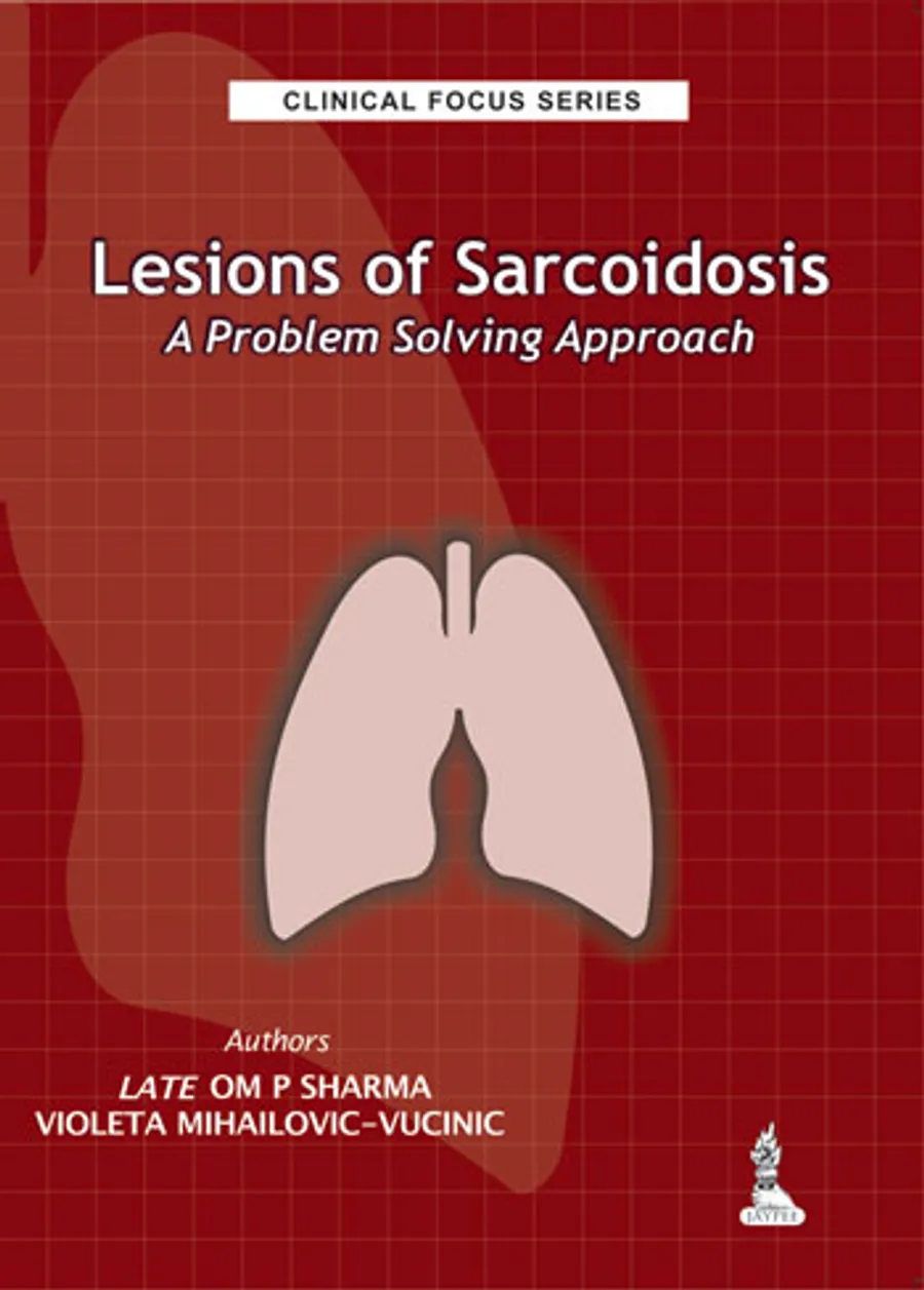 Clinical Focus Series | Lesions of Sarcoidosis-A Problem Solving Approach