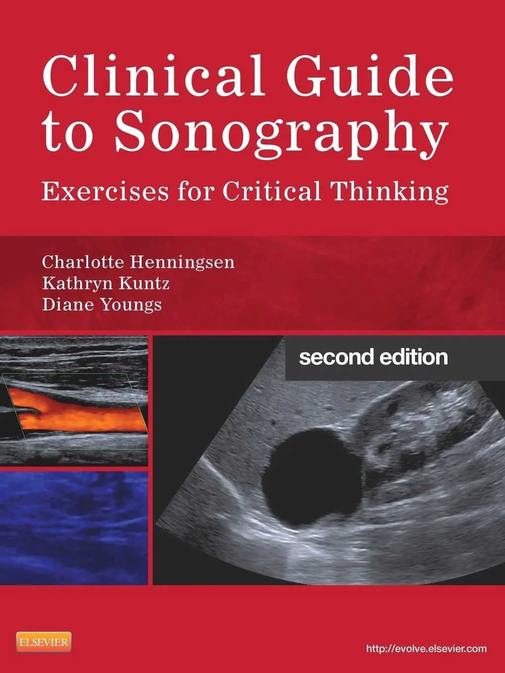 Clinical Guide to Sonography 2/e
