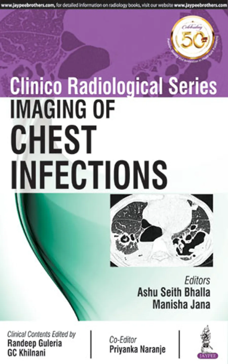 Clinico Radiological Series | Imaging of Chest Infections