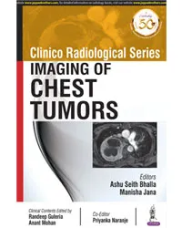 CLINICO RADIOLOGICAL SERIES: IMAGING OF CHEST TUMORS