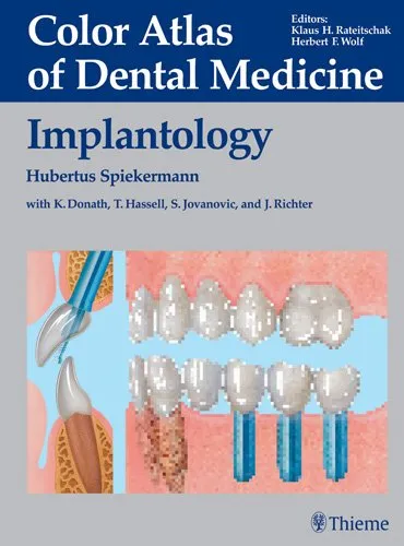Color Atlas of Dental Medicine Implantology - 1st Edition