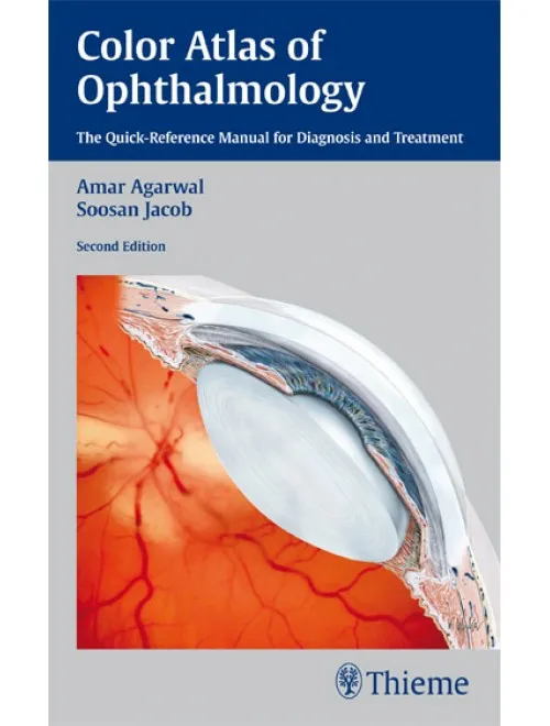 Color Atlas Of Ophthalmology - 2nd Edition