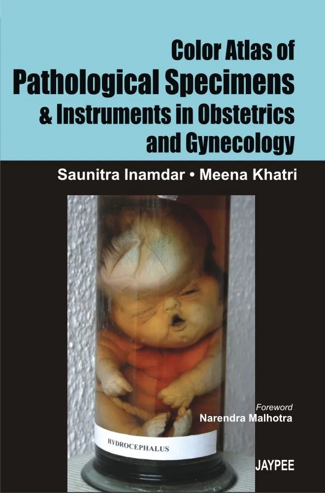 Color Atlas of Pathological Specimens and Instruments in Obstetrics and Gynecology - 1st Edition