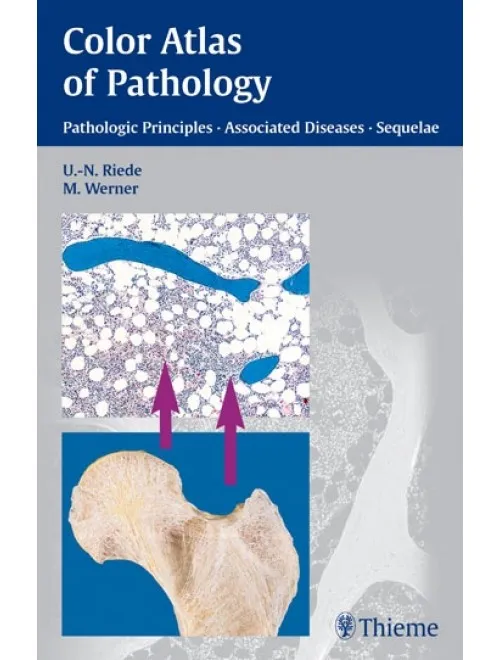 Color Atlas of Pathology - 1st Edition