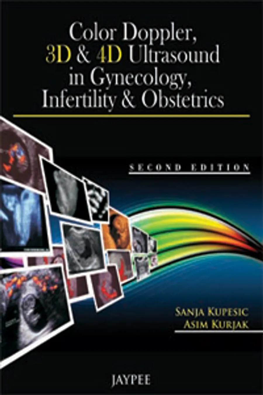 Color Doppler 3D & 4D Ultrasounds in Gynecology Infertility and Obstetrics 2/ed
