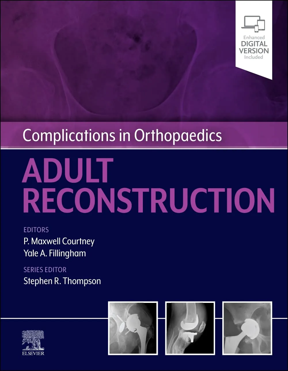 Complications in Orthopaedics: Adult Reconstruction-1E