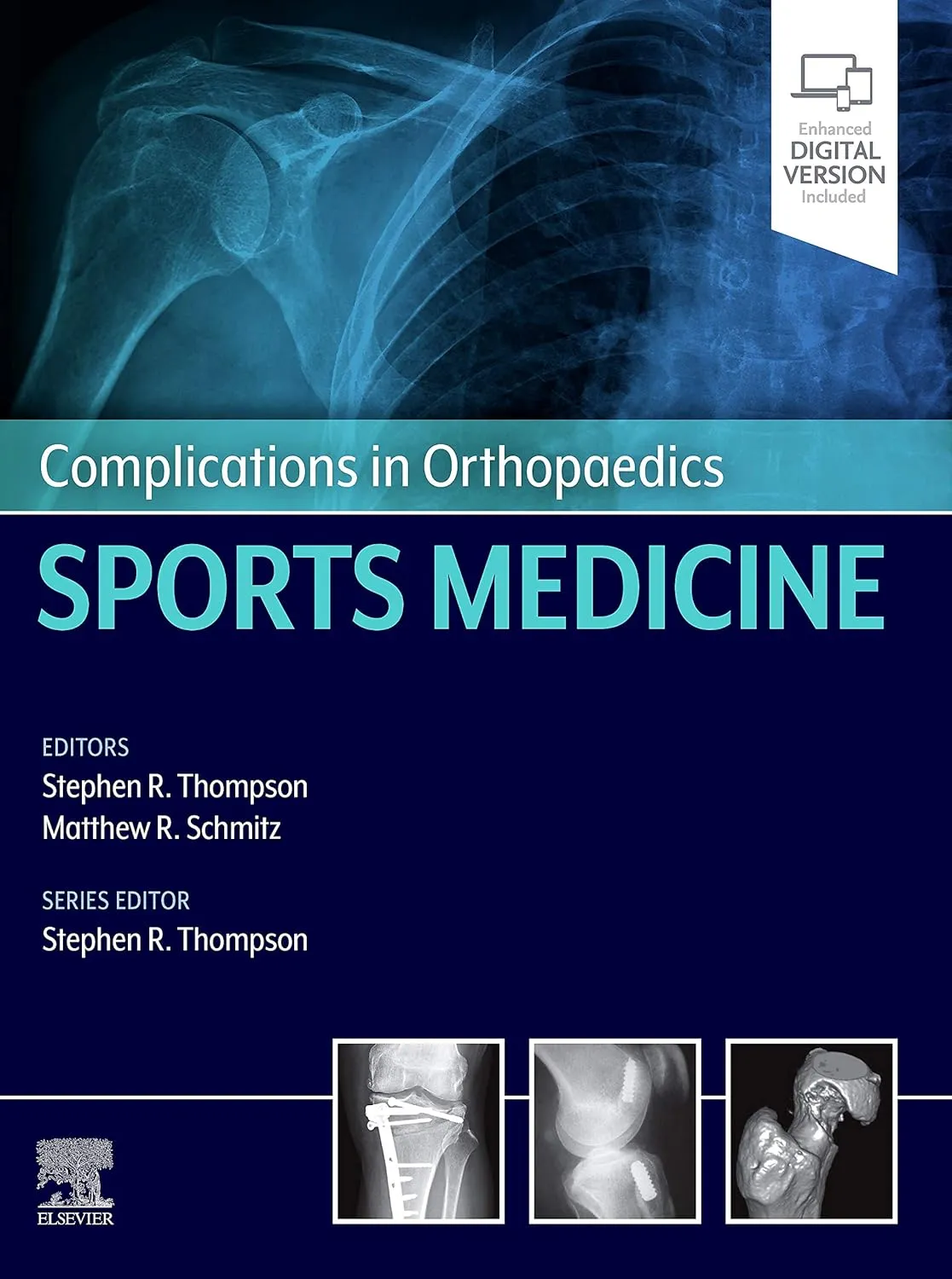 Complications in Orthopaedics: Sports Medicine -1E
