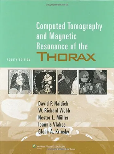 Computed Tomography and Magnetic Resonance of the Thorax - 4th Edition
