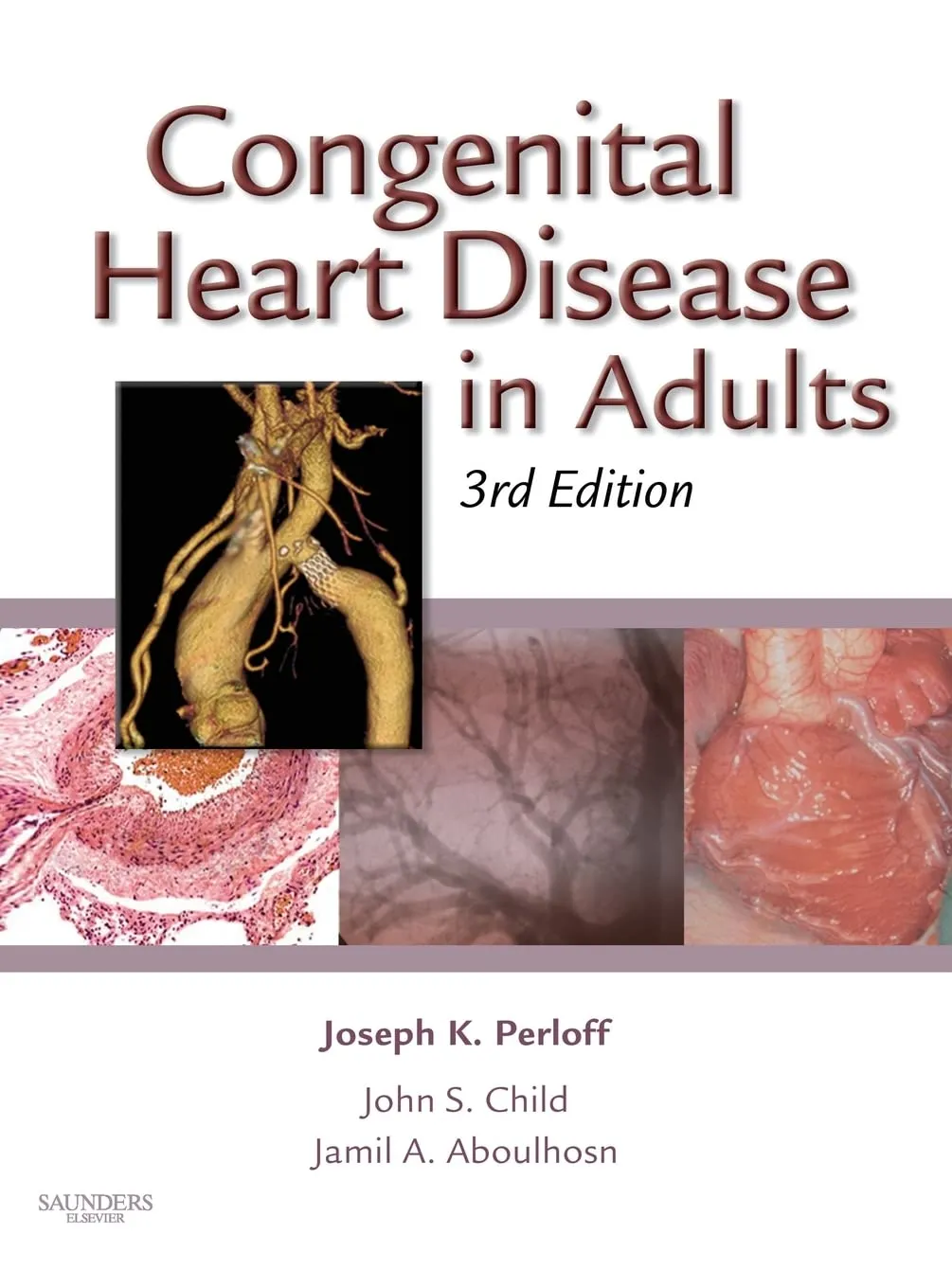 Image of Cogenital Heart Disease/ Adults 3E