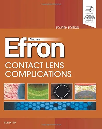 Contact Lens Complications Expert Consult- 4th Edition