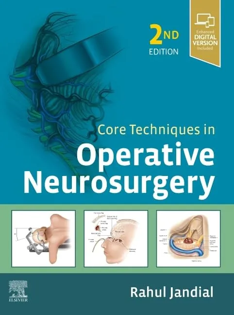 Core Techniques in Operative Neurosurgery: Expert Consult - Online and Print - 2E