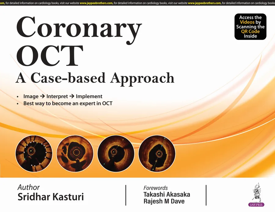 Image of Coronary OCT | A Case-based Approach