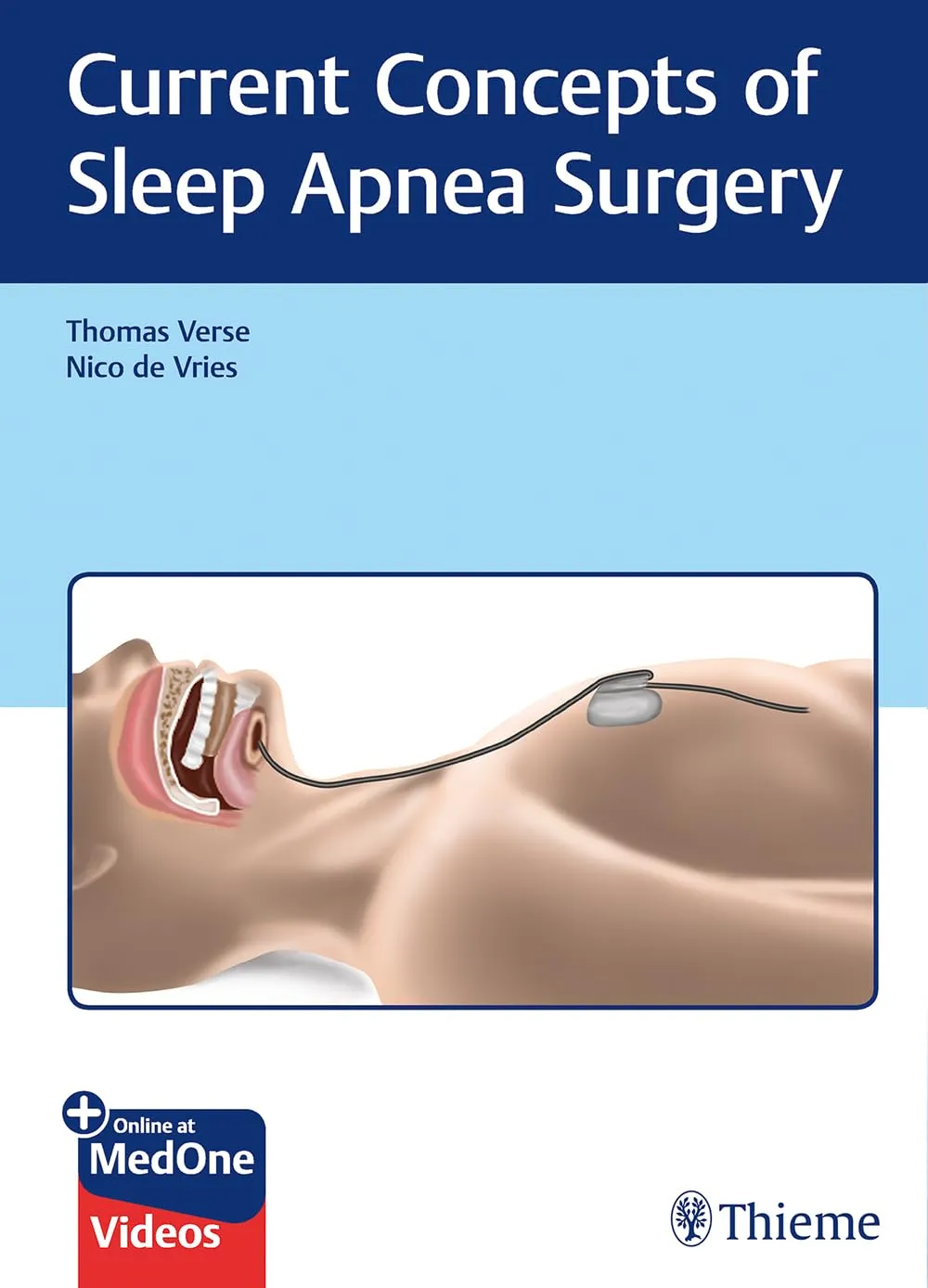 Current Concepts of Sleep Apnea Surgery 1st Ed.