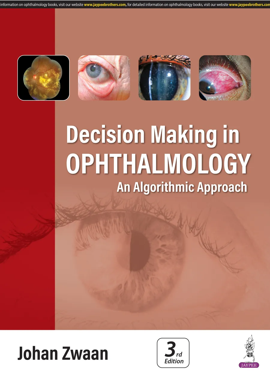 Decision Making in Ophthalmology | An Algorithmic Approach
