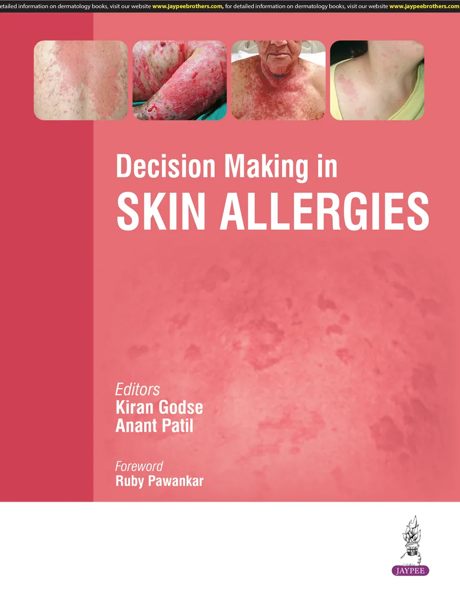 Decision Making in Skin Allergies