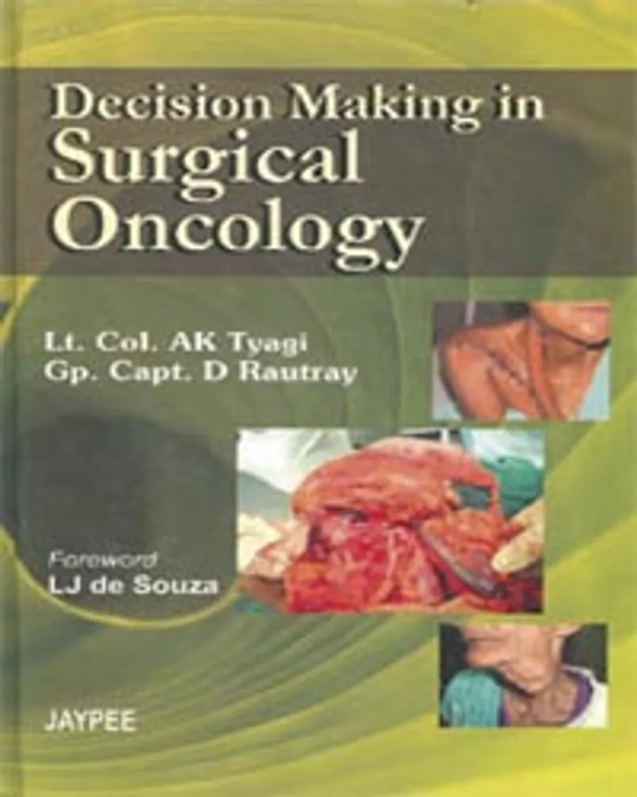 Decision Making in Surgical oncology