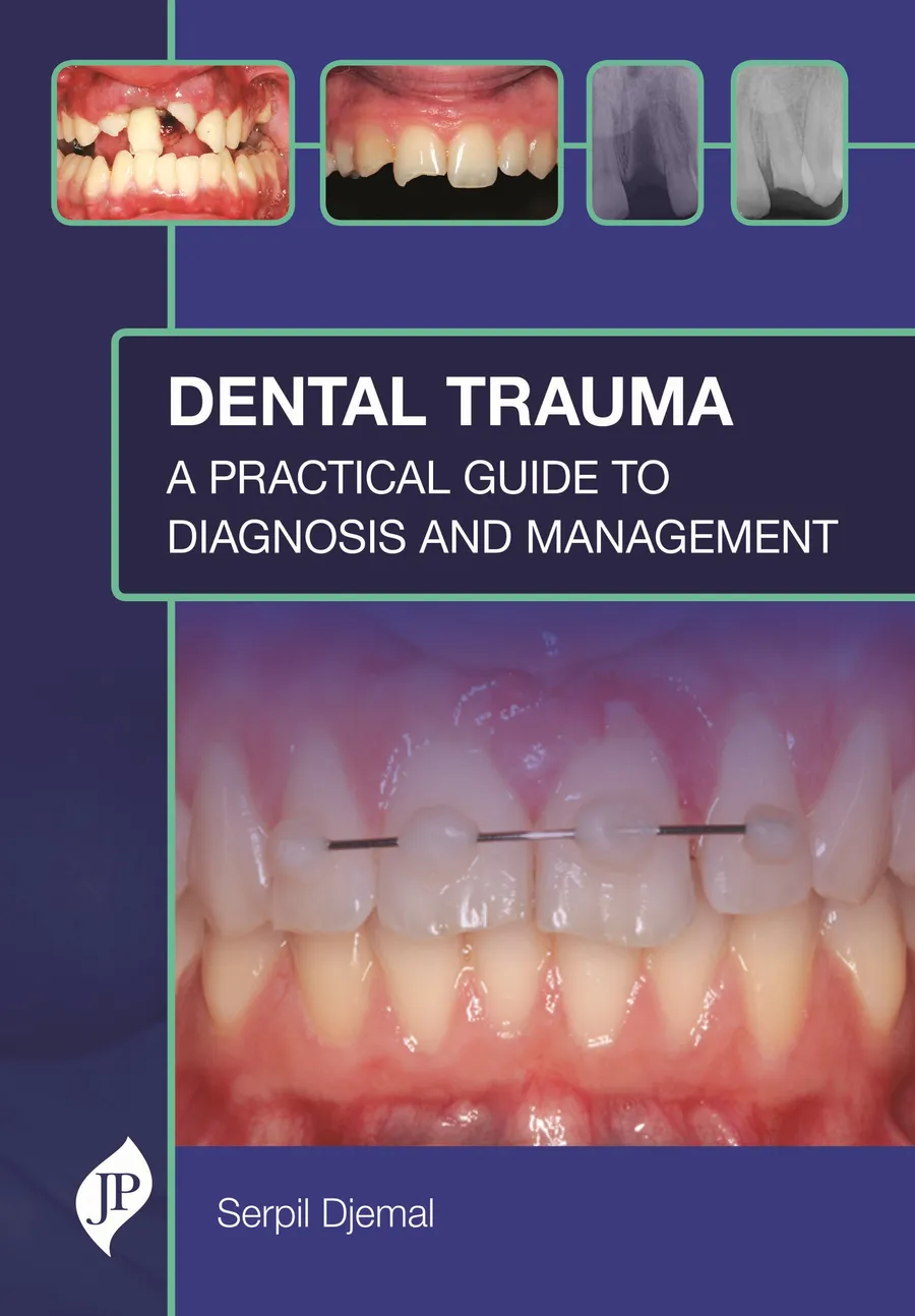 Dental Trauma | A Practical Guide to Diagnosis and Management