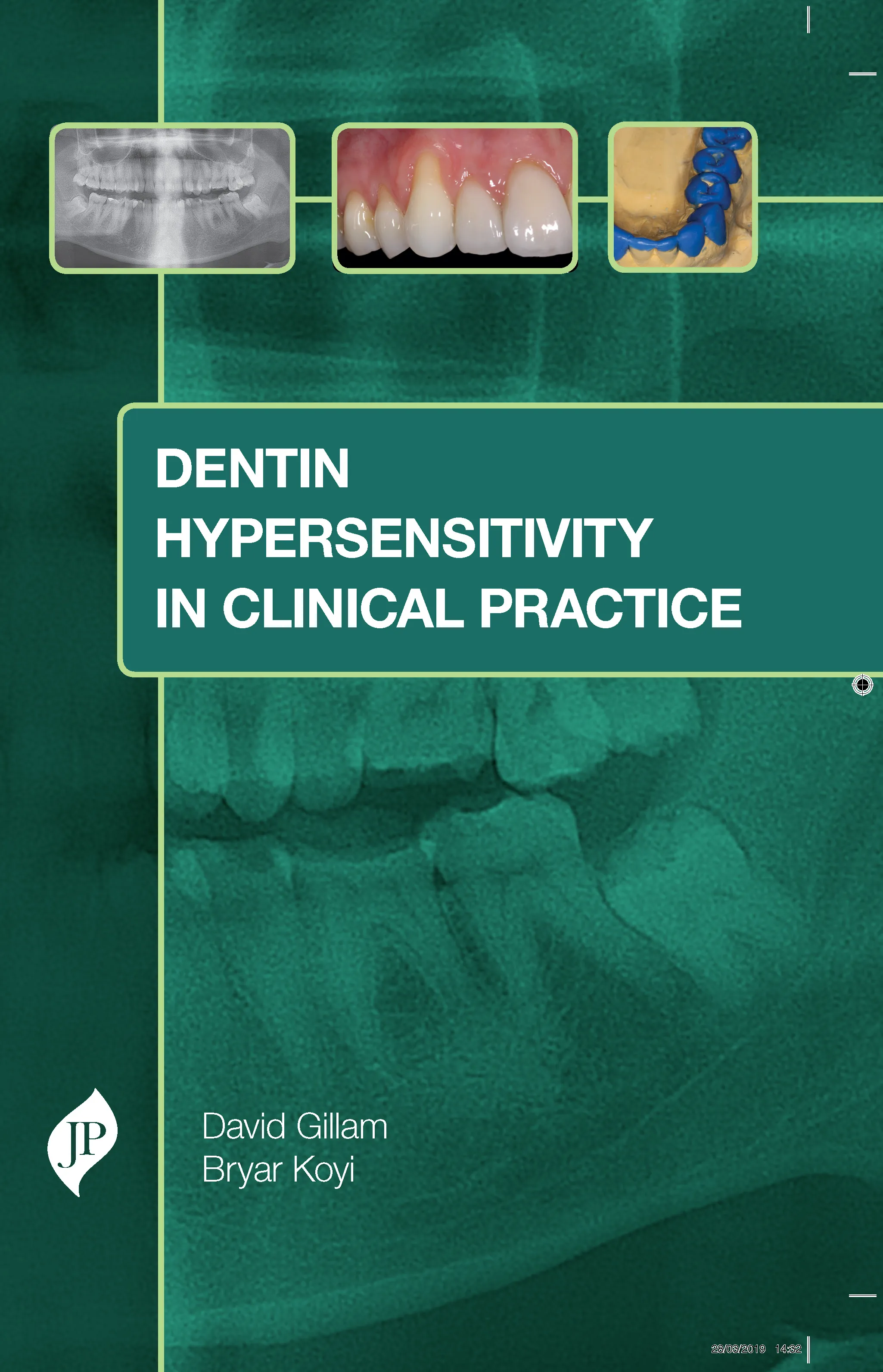 Dentin Hypersensitivity in Clinical Practice - 1st Edition