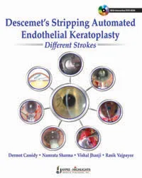 DESCEMET'S STRIPPING AUTOMATED ENDOTHELIAL KERATOPLASTY:DIFFERENT STROKES