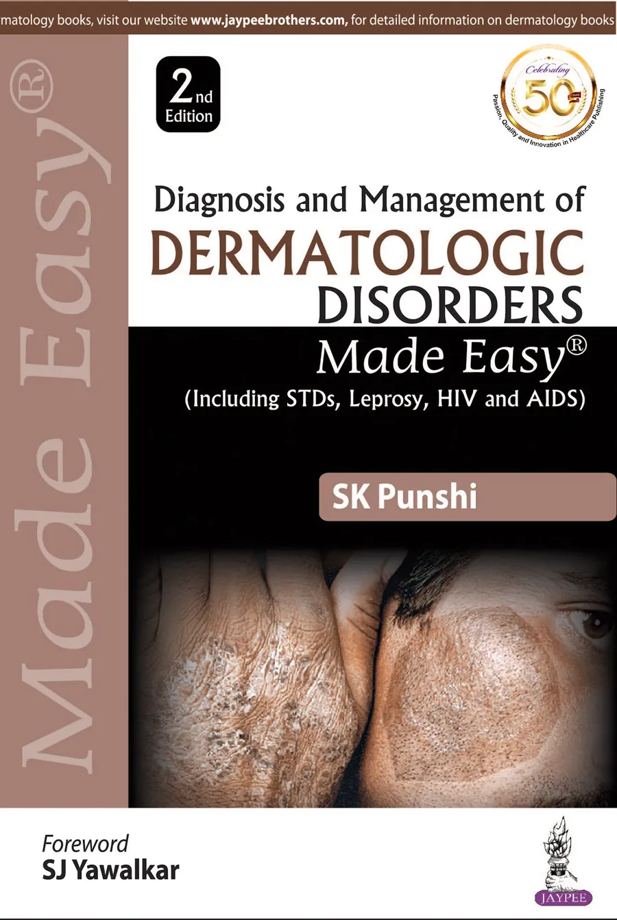 Diagnosis and Management of Dermatologic Disorders Made Easy (including STDs, Leprosy, HIV and AIDS)