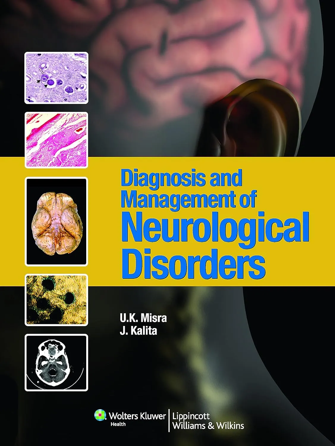 Diagnosis and Management of Neurological Disorders -1E