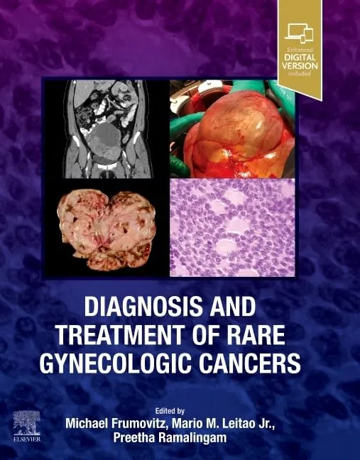 Diagnosis and Treatment of Rare Gynecologic Cancers - 1E