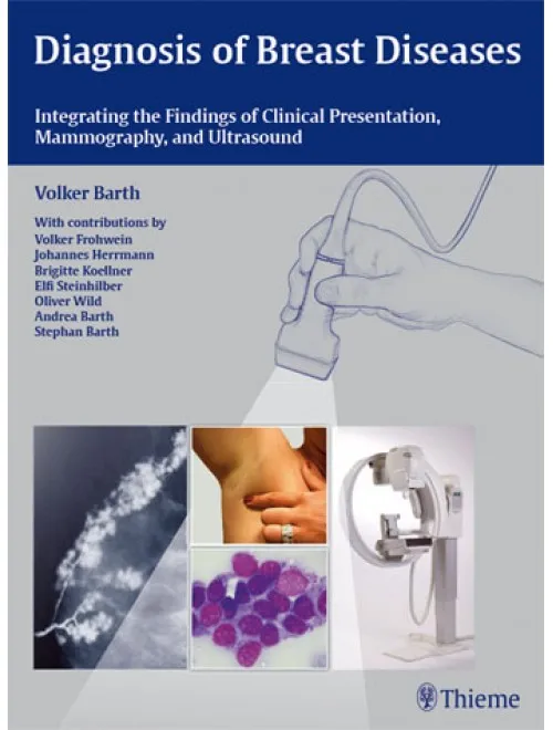Diagnosis of Breast Diseases - 1st Edition