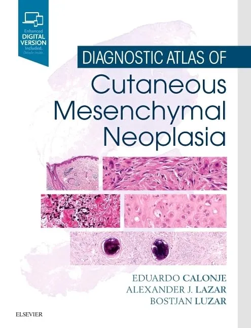 Diagnostic Atlas of Cutaneous Mesenchymal Neoplasia -1E