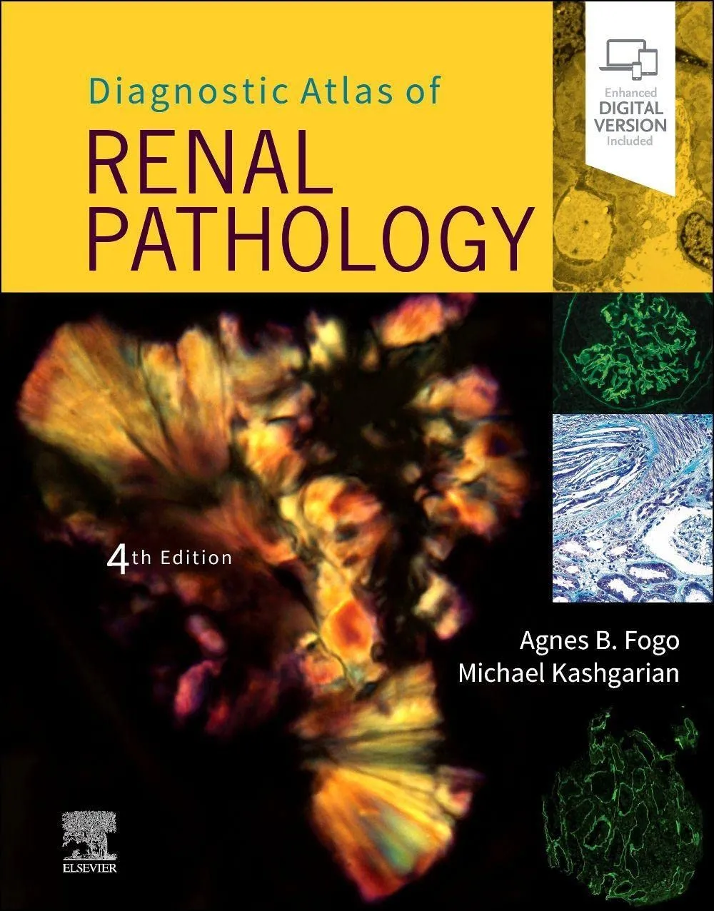 Diagnostic Atlas of Renal Pathology - 4E