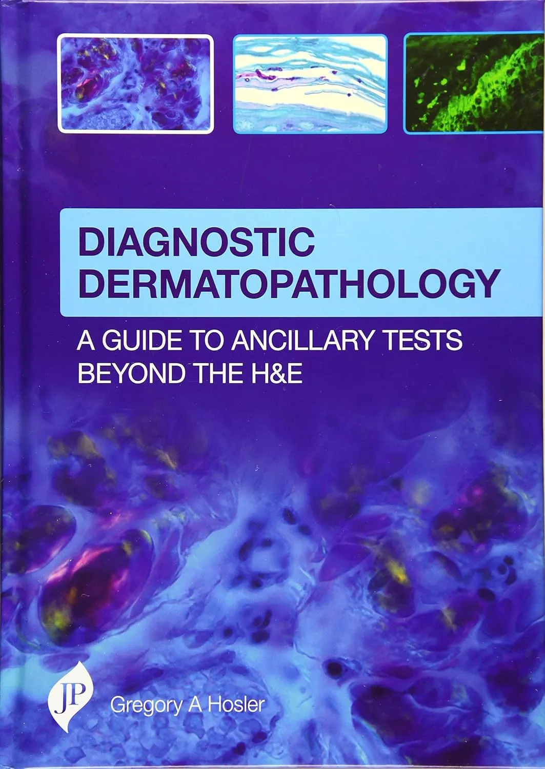 Diagnostic Dermatopathology:A Guide To Ancillary Tests Beyond The H&E-1st Edition 2017
