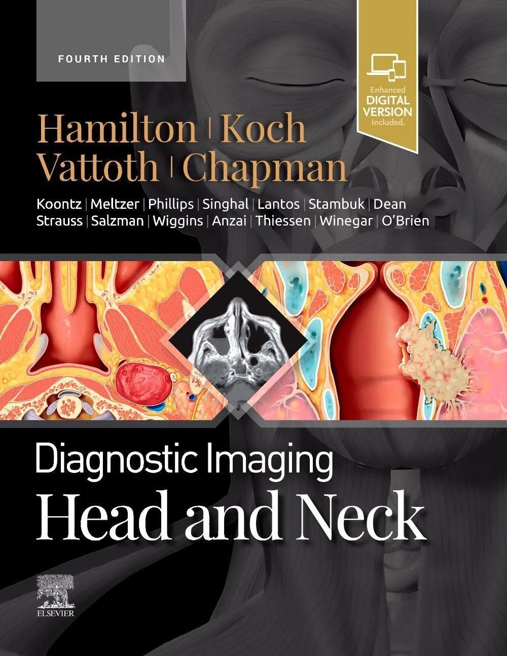 Diagnostic Imaging: Head and Neck -4ED