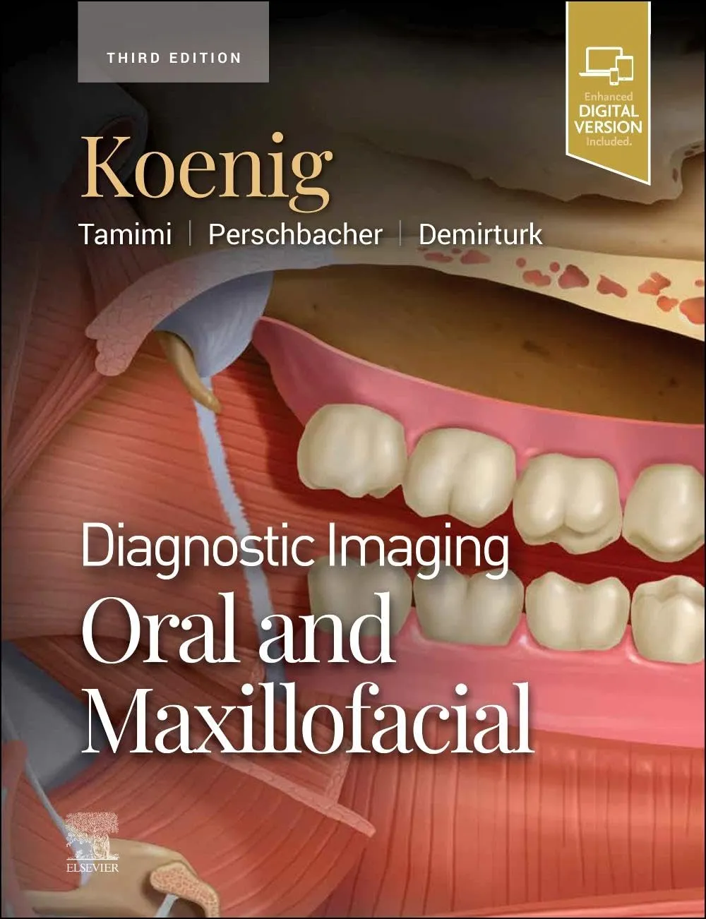 Diagnostic Imaging: Oral and Maxillofacial-3E